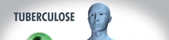 Tuberculose no sistema prisional