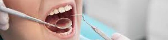 Mitos e verdades: cuidados com a saúde bucal